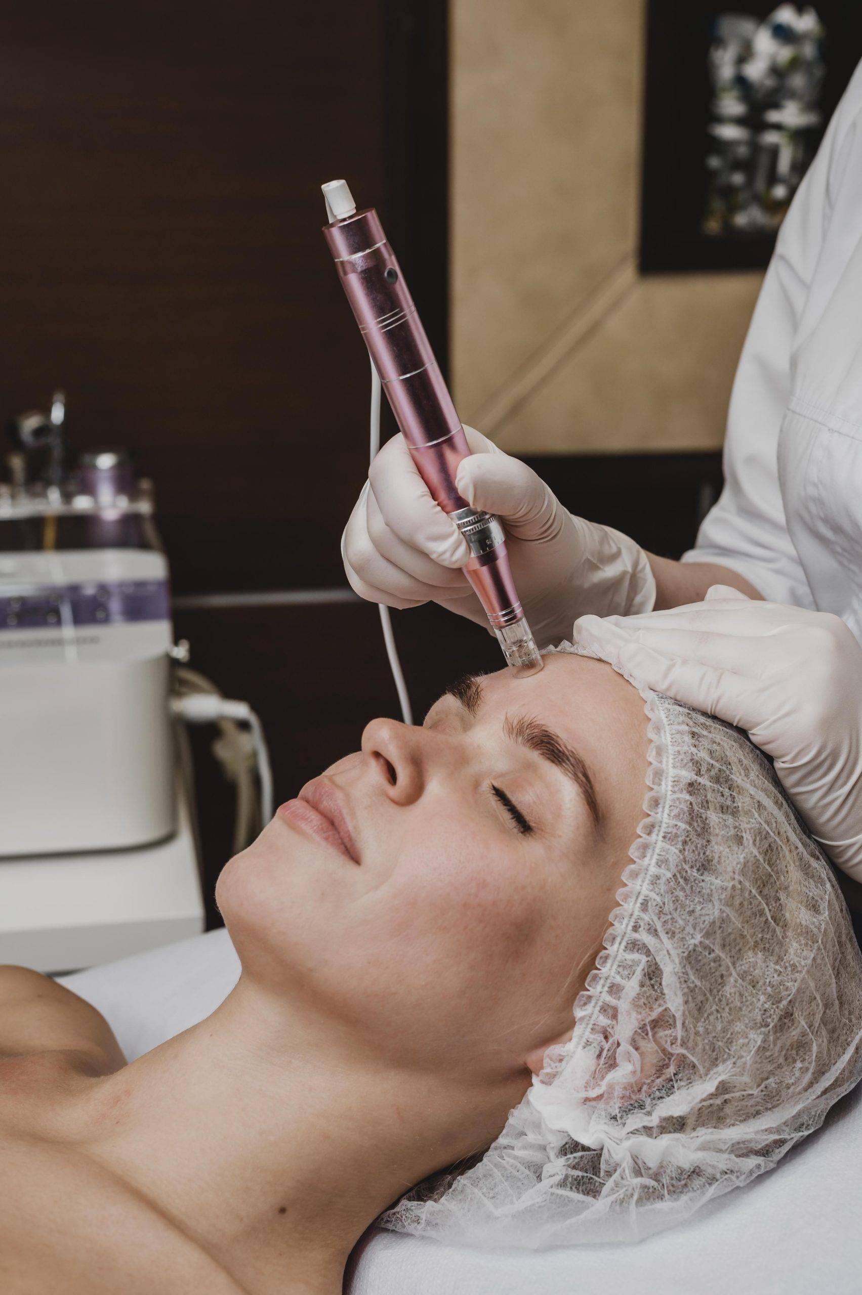 Microneedling in New Jersey | Best Mobile Skin Care Services